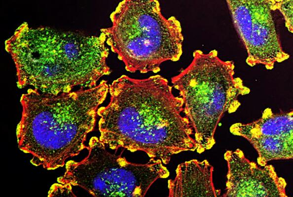 Entering a New Era in Cancer Treatment