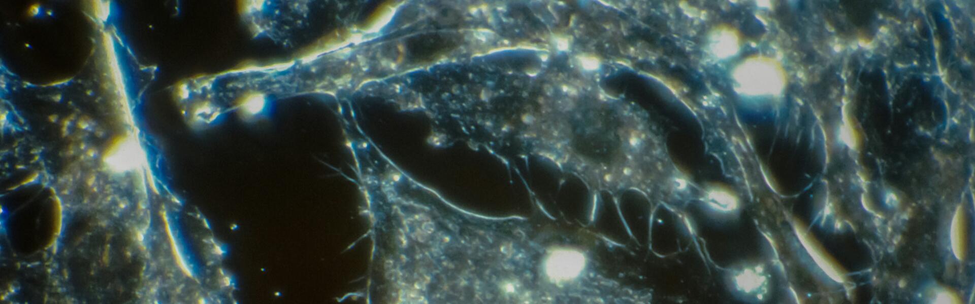 CXCR4: An Important Chemokine Receptor with Multiple Application Fields