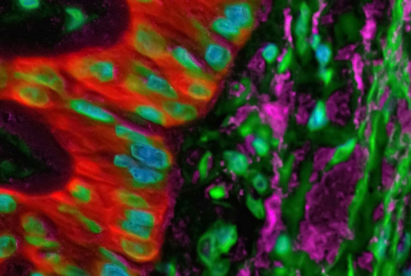 Protein Immunization