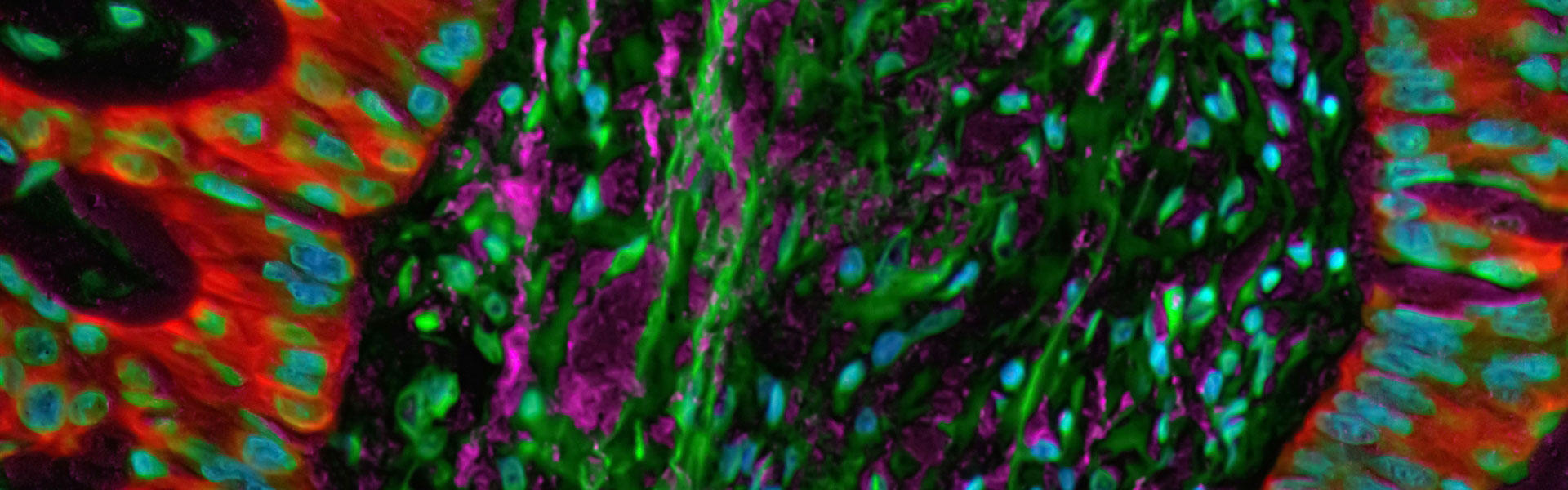 Protein Immunization