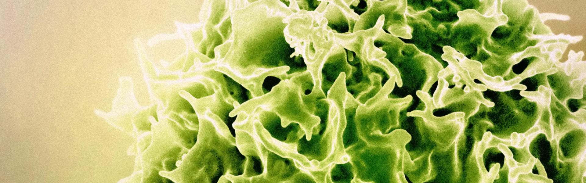 NBLST Immune Library: Facilitating CD5 Therapeutic Drug Research