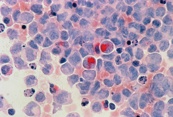 NBLST CD19 Immune Library: Facilitating Drug Research for B Cell-Related Diseases