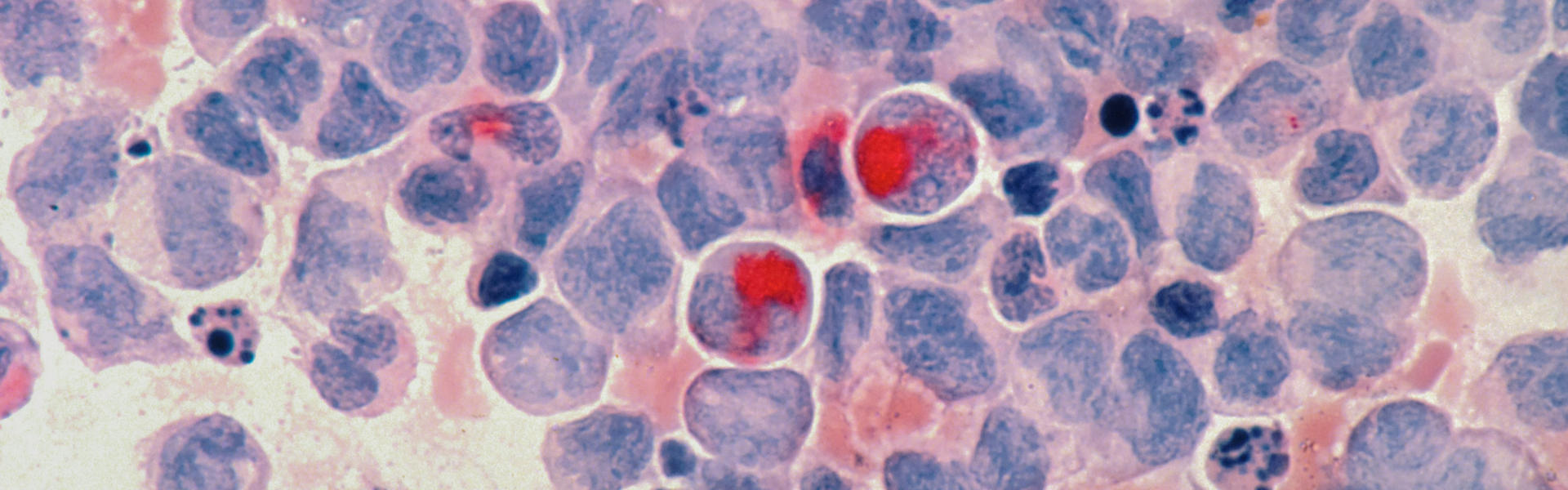 NBLST CD19 Immune Library: Facilitating Drug Research for B Cell-Related Diseases