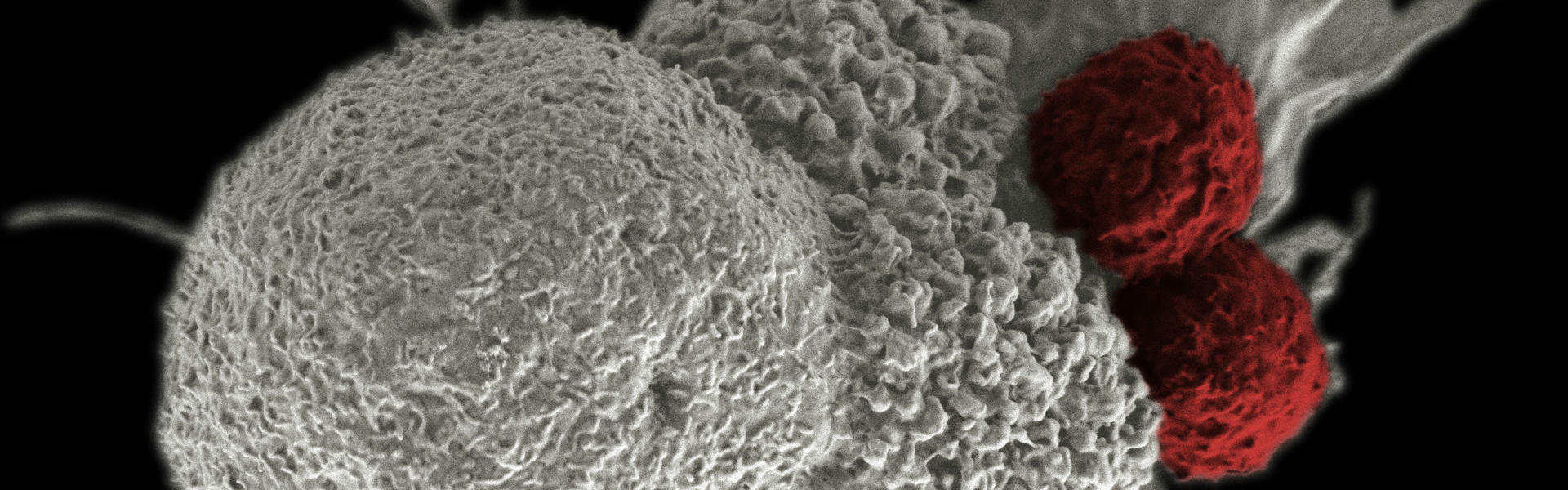 From Clinical Application of the c-MET Target to Nanobody Drug Development