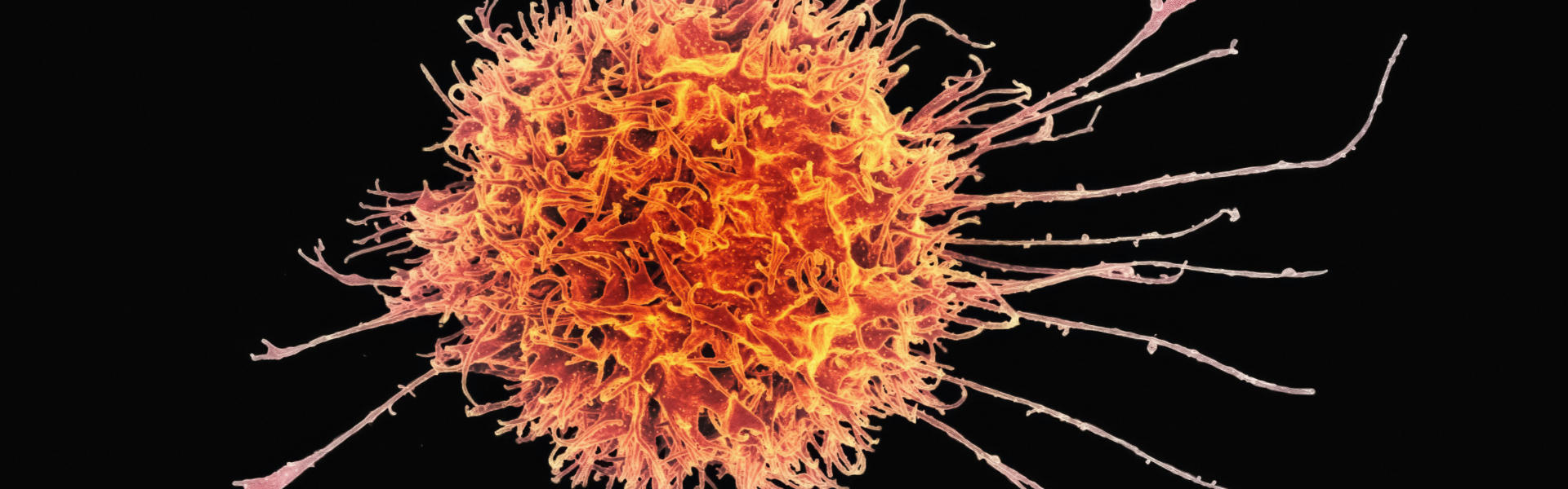 Off-the-Shelf Nanobody Immune Library Empowers Anti-Cancer Therapy: CD7 and Immune Cell Targeting