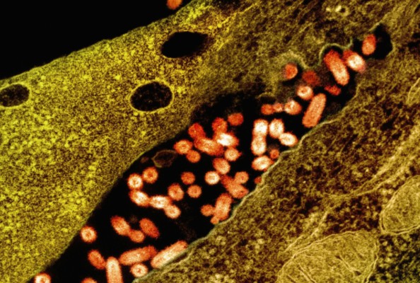 Synergistic Enhancement of Nanobody & VSV-G for Targeted Therapy of HER2-Positive Tumors