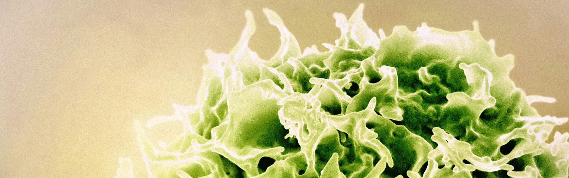 Nanobody-Based Trispecific NK Cell Engager: A Groundbreaking Study in T-Cell Malignancy Treatment