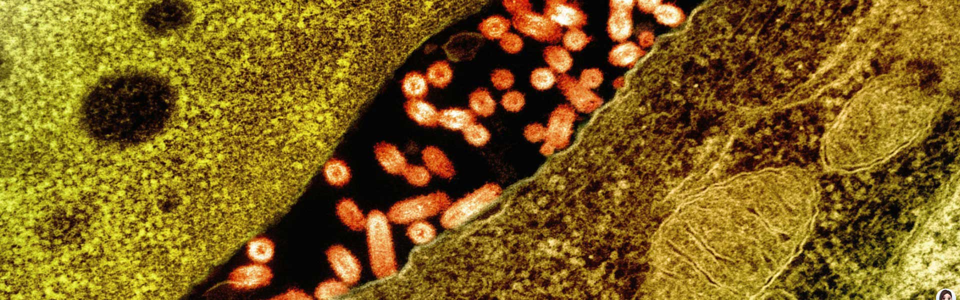 Synergistic Enhancement of Nanobody & VSV-G for Targeted Therapy of HER2-Positive Tumors