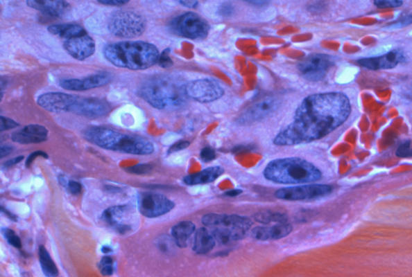 NBLST CD19 Immune Library: Facilitating Drug Research for B Cell-Related Diseases