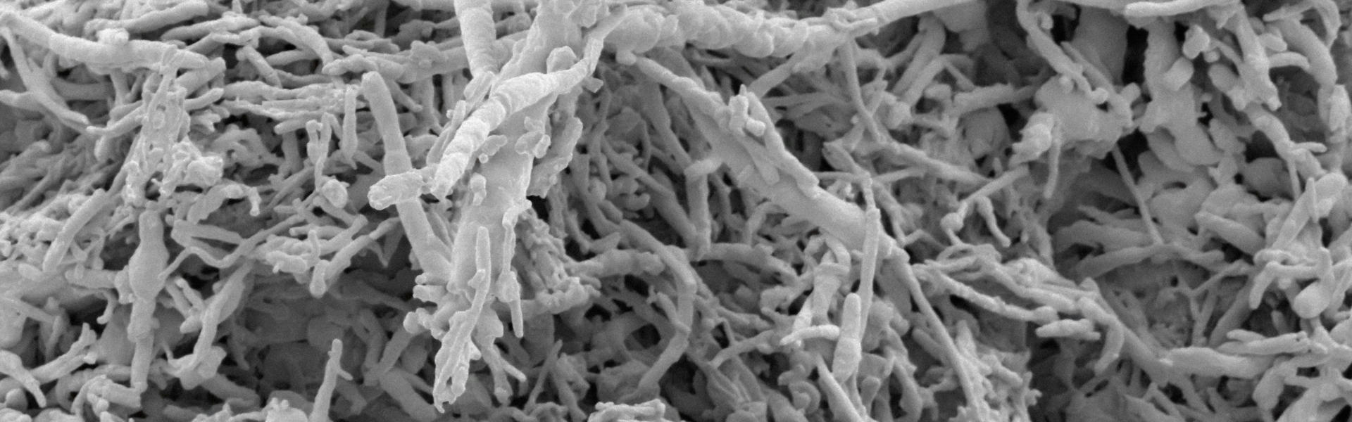 NBLST CD19 Immune Library: Facilitating Drug Research for B Cell-Related Diseases