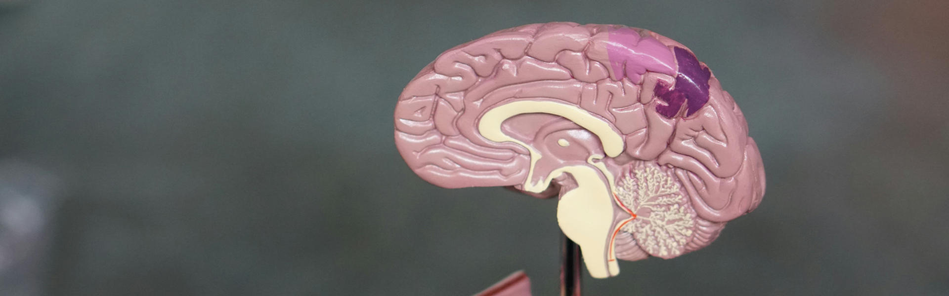 Targeting mGlu to Ameliorate Behavioral Deficits Associated with NMDA Receptor Hypofunction