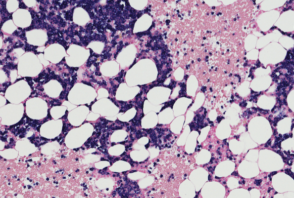 Nanobodies Empower Innovative Drugs! First Patient Dosed in Phase III Clinical Trial of JSKN016