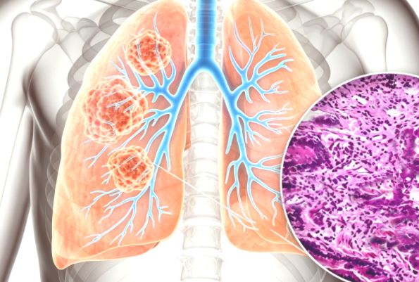 The Disruptive Value of DLL3-Targeted Innovative Therapies and Nanobodies