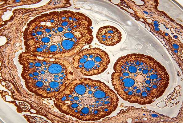 HER2 BsAb Triumphs: Nanobodies Open a New Frontier