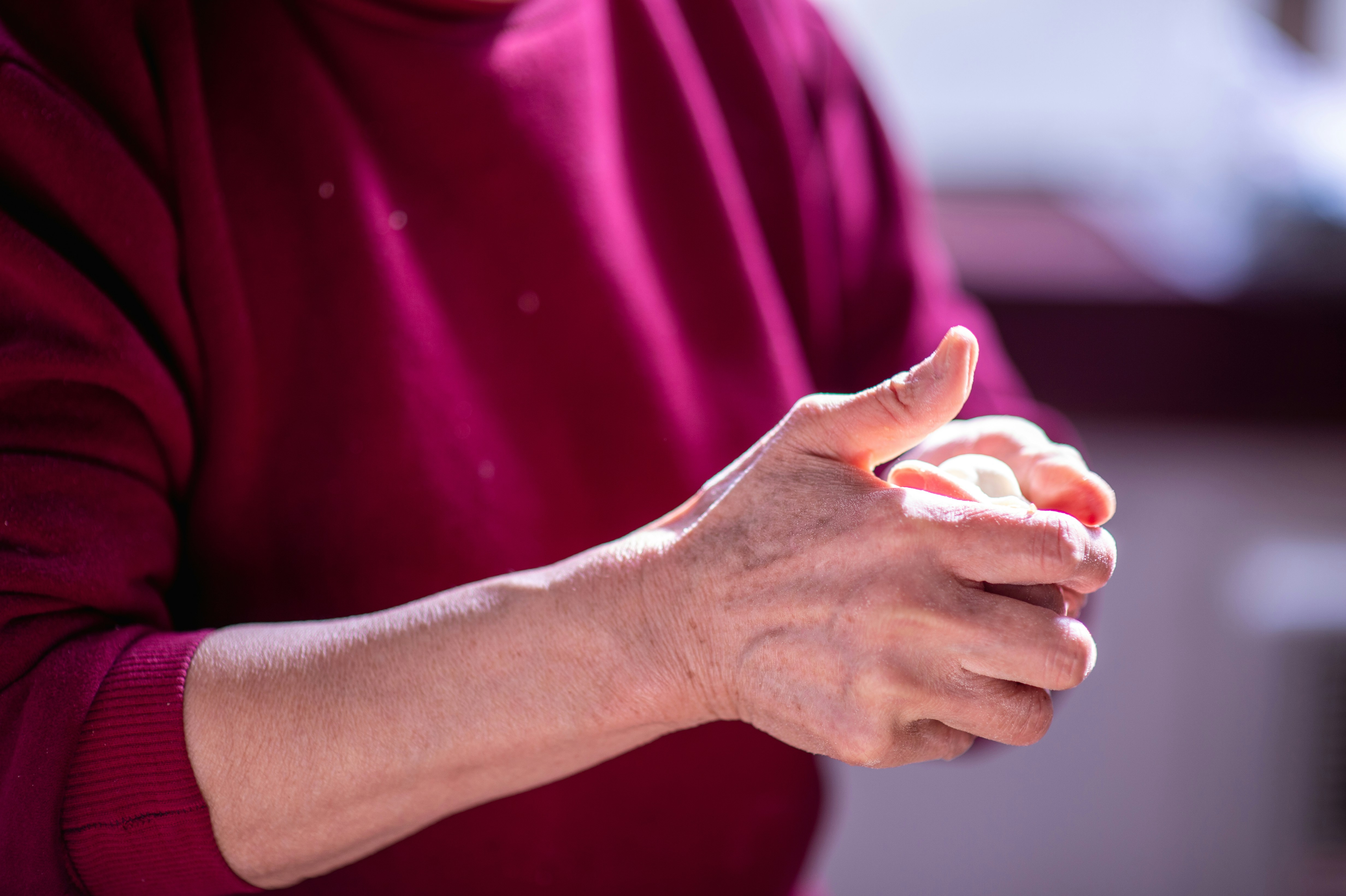 Sonelokimab Trivalent Nanobody: Phase III Data Fully Met